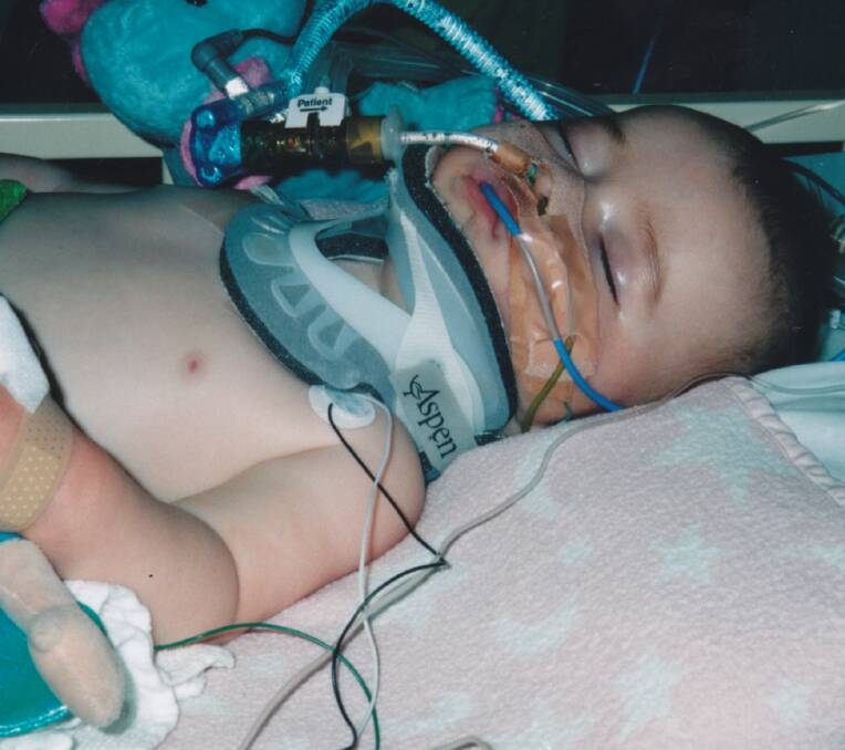 TRAGEDY: Alanna suffered an acquired catastrophic hypoxic brain injury after suffocating in her cot. 