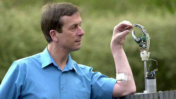 Contact: Professor Kevin Warwick and his microchipped arm. Photo: REX