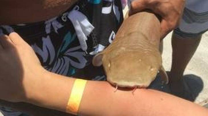 The small nurse shark latched onto the woman's right arm. Photo: Boca Raton Fire Rescue