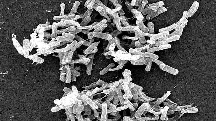 Dark times ahead ... the highly toxic strains of <i>Clostridium difficile</i> are not subject to routine testing making it difficult to determine how widespread it is.